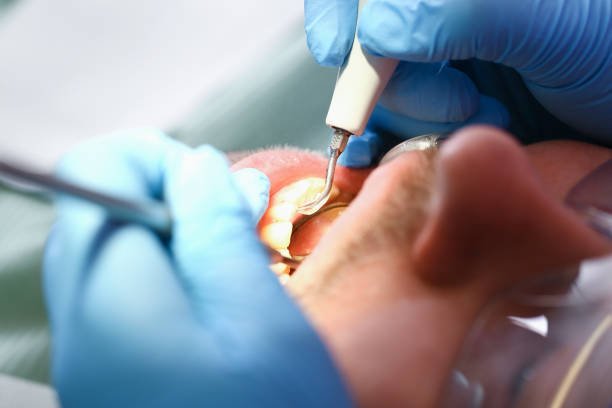 Best Broken or Cracked Tooth Emergency Dentist in Sand Ridge, NY